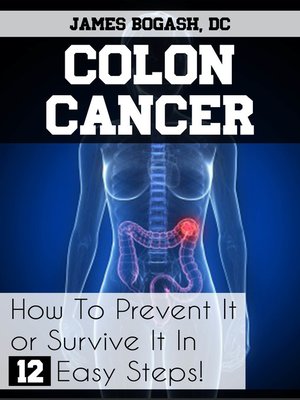 cover image of Colon Cancer